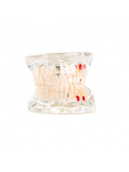 model of teeth Easyinsmile Half side can be removeble teeth model Patient & Student Education Teeth Model