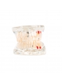 model of teeth Easyinsmile Half side can be removeble teeth model Patient & Student Education Teeth Model