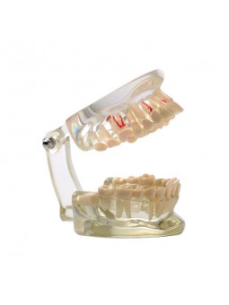 teeth models dental anatomy Easyinsmile Adult Teeth Model Pathological Dental Teaching Study Model 