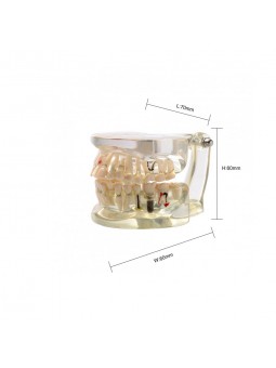 teeth models dental anatomy Easyinsmile Adult Teeth Model Pathological Dental Teaching Study Model