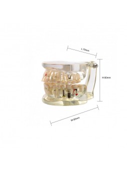 teeth models dental anatomy Easyinsmile Adult Teeth Model Pathological Dental Teaching Study Model 
