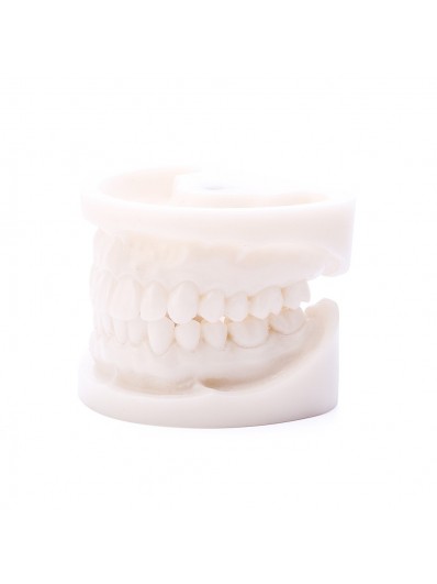 Easyinsmile Dental Teeth Study Teaching Model Clear Mixed Dentition Model with Missing Teeth Pathology Model for Dental Education 