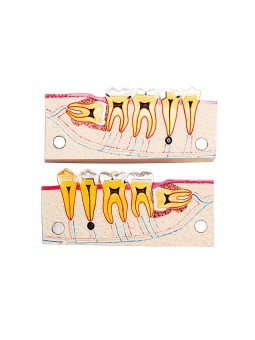 Dental teeth model of EASYINSMILE Disease Teeth Anatomy Study Model Molar Cross Section Model