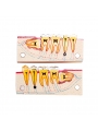 Dental teeth model of EASYINSMILE Disease Teeth Anatomy Study Model Molar Cross Section Model