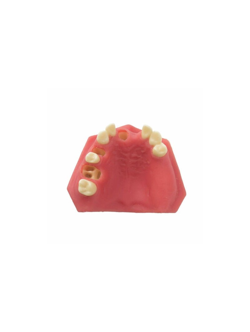 Teeth Study Model Of EASYINSMILE Lower Jaw Typodont Teeth Study Model Implant Practice Model