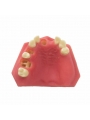 Teeth Study Model Of EASYINSMILE Lower Jaw Typodont Teeth Study Model Implant Practice Model