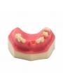 Teeth Study Model Of EASYINSMILE Lower Jaw Typodont Teeth Study Model Implant Practice Model