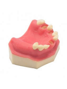 Teeth Study Model Of EASYINSMILE Lower Jaw Typodont Teeth Study Model Implant Practice Model