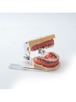 Teach Model 1Pcs Dental Teeth Periodontal Periodontitis Soft Gingivitis Study Lab Model EASYINSMILE