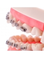Dental Ortho Standard Teeth Model Metal Bracket Wires Typodont Model EASYINSMILE