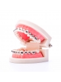 Dental Ortho Standard Teeth Model Metal Bracket Wires Typodont Model EASYINSMILE