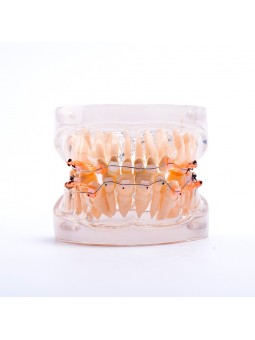 Dental teeth model orthodontic ceramic brackets archwire model for dentist lab Easyinsmile