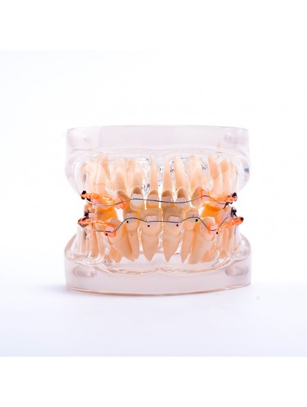 Dental teeth model orthodontic ceramic brackets archwire model for dentist lab Easyinsmile