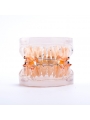 Dental teeth model orthodontic ceramic brackets archwire model for dentist lab Easyinsmile