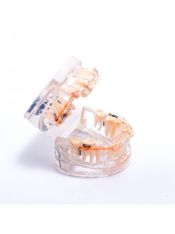 Dental teeth model orthodontic ceramic brackets archwire model for dentist lab Easyinsmile