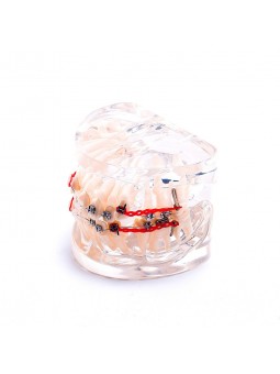  Dental Orthodontic Teeth Model Metal&Ceramic Brackets Contrast Model EASYINSMILE