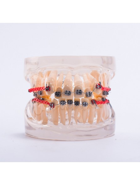 Dental orthodontic study teeth model Easyinsmile Metal brackets Archwires teeth model