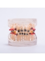 Dental orthodontic study teeth model Easyinsmile Metal brackets Archwires teeth model