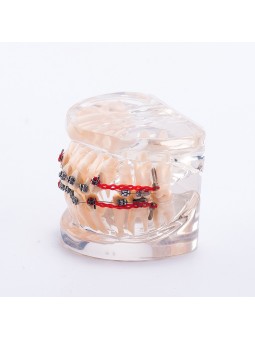 Dental orthodontic study teeth model Easyinsmile Metal brackets Archwires teeth model