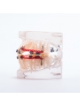 Dental orthodontic study teeth model Easyinsmile Metal brackets Archwires teeth model
