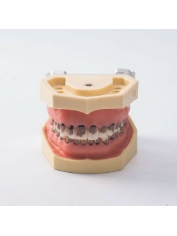 1Pcs Dental Teeth Periodontal Periodontitis Soft Gingivitis Study Teach Model 