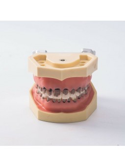 1Pcs Dental Teeth Periodontal Periodontitis Soft Gingivitis Study Teach Model