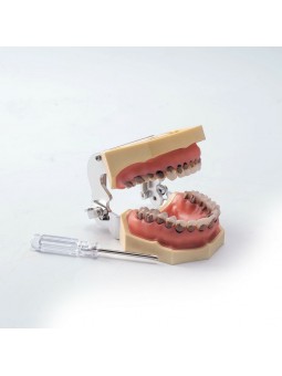 1Pcs Dental Teeth Periodontal Periodontitis Soft Gingivitis Study Teach Model