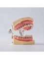 1Pcs Dental Teeth Periodontal Periodontitis Soft Gingivitis Study Teach Model 