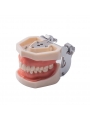 Dental Standard Teeth Model EASYINSMILE Dental Standard Removable Teeth Model 200H Type Soft Gum With Tool