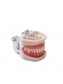 Dental Standard Teeth Model EASYINSMILE Dental Standard Removable Teeth Model 200H Type Soft Gum With Tool