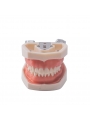 Dental Standard Teeth Model EASYINSMILE Dental Standard Removable Teeth Model 200H Type Soft Gum With Tool