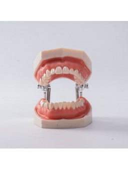 Dental Standard Teeth Model EASYINSMILE Dental Standard Removable Teeth Model 200H Type Soft Gum With Tool