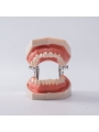 Dental Standard Teeth Model EASYINSMILE Dental Standard Removable Teeth Model 200H Type Soft Gum With Tool