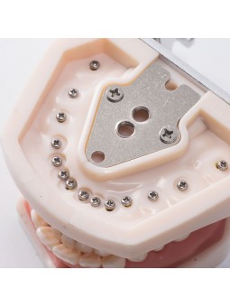 Dental Standard Teeth Model EASYINSMILE Dental Standard Removable Teeth Model 200H Type Soft Gum With Tool