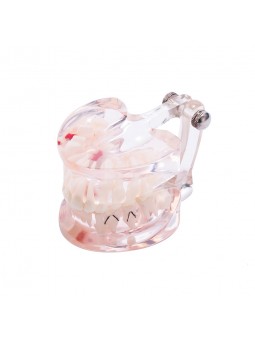 Dental Study Teeth Model Pathological Disease Demonstration Model EASYINSMILE