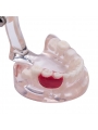 Dental Study Teeth Model Pathological Disease Demonstration Model EASYINSMILE 