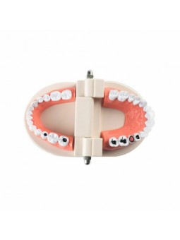 Dental Study Teaching Model Teeth Caries Tooth Care Model Adult Size EASYINSMILE