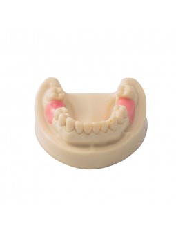 Dental Teeth Model EASYINSMILE Missing the 6 on the left and the 6 on the right Model