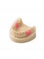 Dental Teeth Model EASYINSMILE Missing the 6 on the left and the 6 on the right Model 	