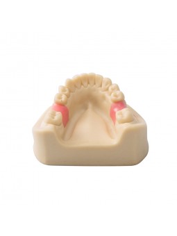 Dental Teeth Model EASYINSMILE Missing the 6 on the left and the 6 on the right Model 	