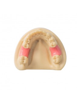 Dental Teeth Model EASYINSMILE Missing the 6 on the left and the 6 on the right Model 	