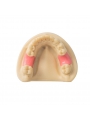 Dental Teeth Model EASYINSMILE Missing the 6 on the left and the 6 on the right Model 	