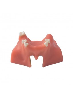 Dental Model Sinus Lift Practice Model Study Education Teeth Model EASYINSMILE Style A