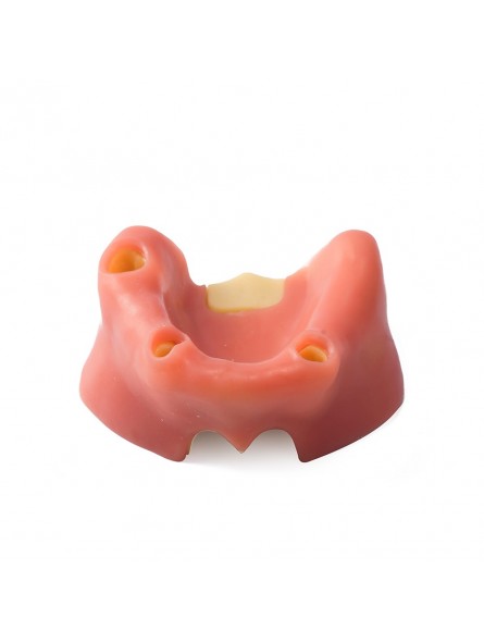 Dental Model Sinus Lift Practice Model Study Education Teeth Model Style B EASYINSMILE