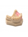 Dental Teeth Upper Jaw Missing ModelEASYINSMILE Missing the 5 on the left and the 1,4,5 on the right Model