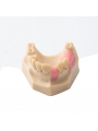 Dental Teeth Upper Jaw Missing ModelEASYINSMILE Missing the 5 on the left and the 1,4,5 on the right Model