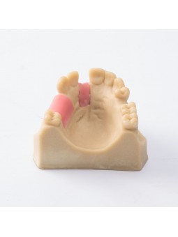 Dental Teeth Upper Jaw Missing ModelEASYINSMILE Missing the 5 on the left and the 1,4,5 on the right Model