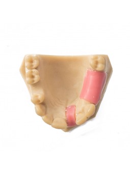 Dental Teeth Upper Jaw Missing ModelEASYINSMILE Missing the 5 on the left and the 1,4,5 on the right Model