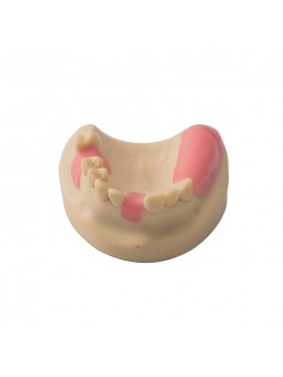 Dental Teeth Upper Jaw Missing ModelEASYINSMILE Missing the 1,6 on the left and the 4,5,6,7 on the right Model