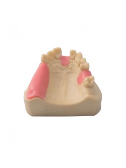 Dental Teeth Upper Jaw Missing ModelEASYINSMILE Missing the 1,6 on the left and the 4,5,6,7 on the right Model